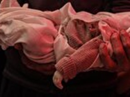 کاربرد تسلیحات مرموز در غزه؛ شهادت کودکان بدون آثار جراحت ظاهری