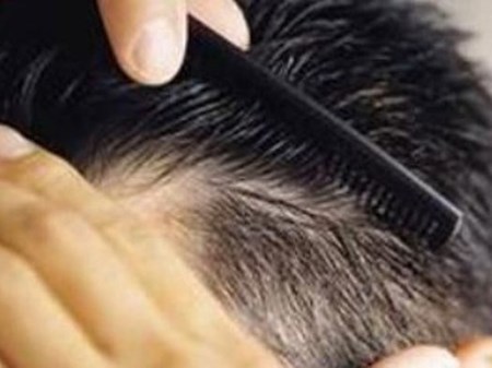 راهکارهای طب ایرانی برای تقویت مو؛ تجربه‌ای طبیعی و کم‌هزینه
