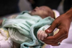 هشدار بهداشت خوزستان به افزایش موارد سوتغذیه در کودکان
