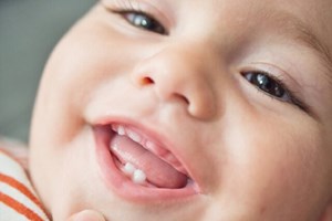 چگونگی مدیریت تشنج در کودکان در شرایط اضطراری و نبود دسترسی فوری به پزشک