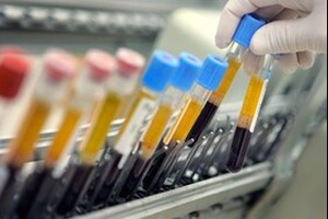 محرومیت یک وزنهبردار و یک جودوکار به دلیل دوپینگ
