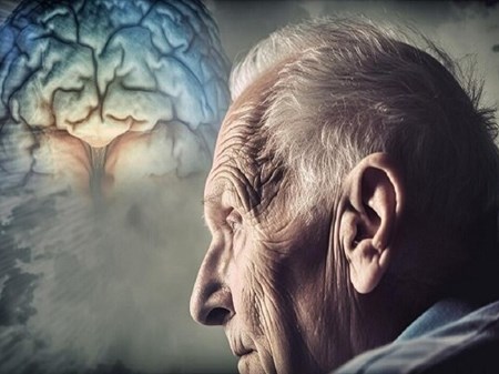 ارتباط مُسکن‌ها با خطر ابتلا به زوال عقل