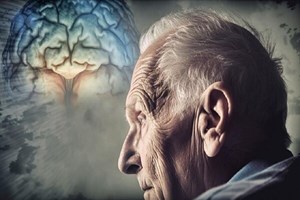 ارتباط مُسکن‌ها با خطر ابتلا به زوال عقل