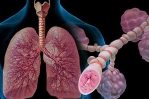 شیوع ۹ درصدی علائم آسم در بزرگسالان / تاثیر حیوانات خانگی بر شدت بیماری