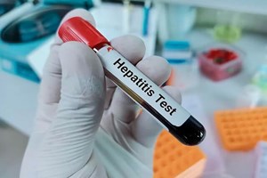 غربالگری هپاتیت در معتادان تحت درمان از اواخر شهریور / دارو و درمان رایگان هپاتیت در کشور
