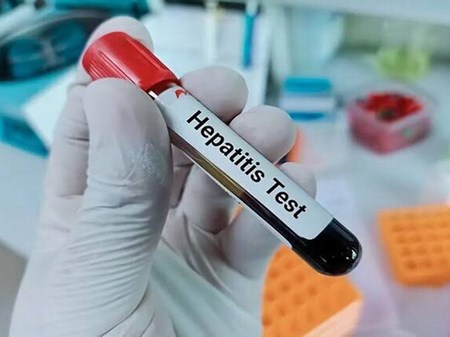 ابتلا به هپاتیت زیر سایه ناآگاهی