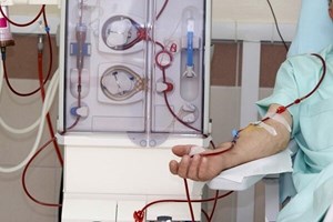 معرفی ۵ ماده غذایی برتر برای جلوگیری از سنگ کلیه