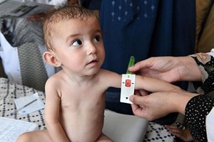 گزارش یونیسف: کودکان در سراسر جنوب آسیا با بحران تغذیه روبرو هستند